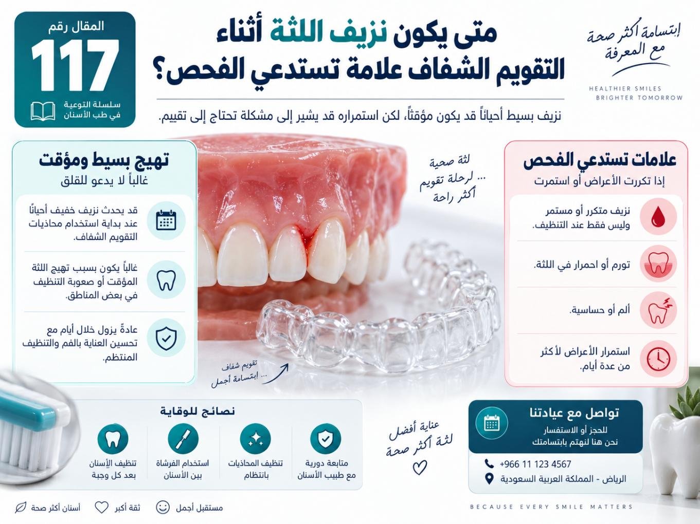 متى يكون نزيف اللثة أثناء التقويم الشفاف علامة تستدعي الفحص؟