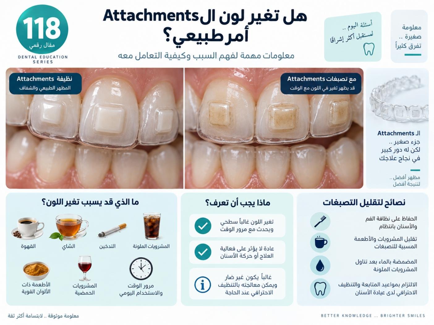 هل تغير لون الـ Attachments أمر طبيعي؟
