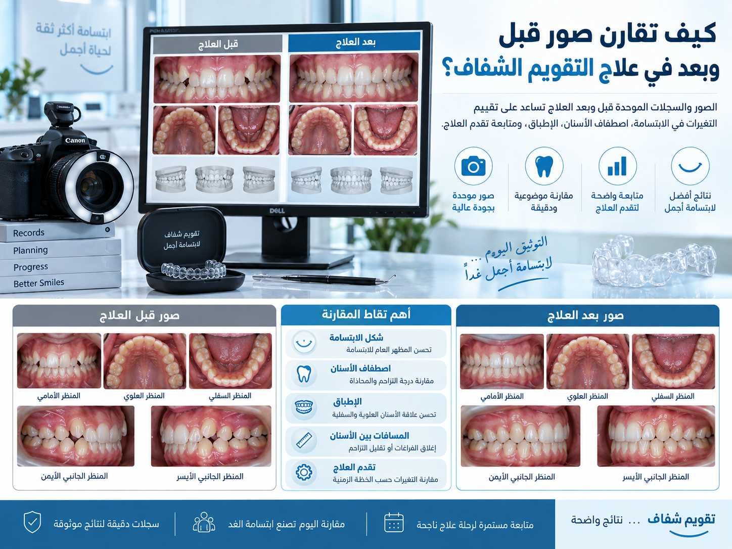 كيف تقارن صور قبل وبعد في علاج التقويم الشفاف؟