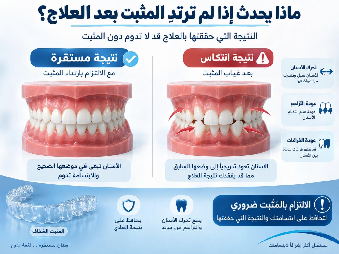 ماذا يحدث إذا لم ترتدِ المثبت بعد العلاج؟