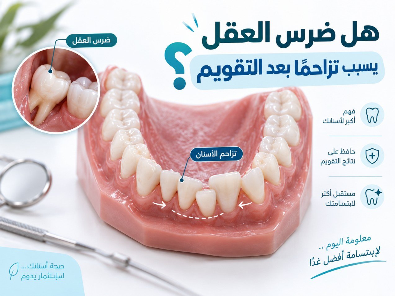 هل ضرس العقل يسبب تزاحمًا بعد التقويم؟