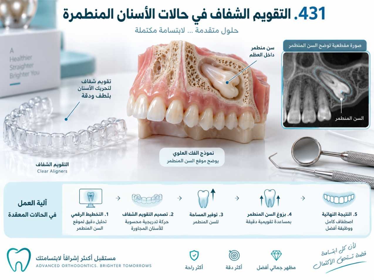 التقويم الشفاف في حالات الأسنان المنطمرة